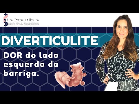 Vídeo: O Que Causa Dor Na Parte Inferior Do Abdômen à Esquerda