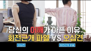 &#39;당신의 어깨가 아픈 이유, 회전근개 파열 vs 오십견 | 어깨 | 명의 | #EBS건강