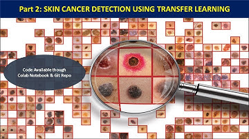Part 2 | Skin Cancer Detection Using Transfer Learning Deep CNN Approach | Model Building