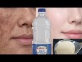 الخل على الخميرة يزيل سواد 20 سنه تبييض الوجه والجسم والمناطق الحساسة في 5 دقائق فقط