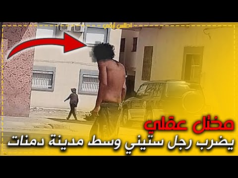 مختل عقلي يضرب رجل ستيني وسط مدينة دمنات