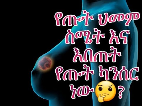 ቪዲዮ: በግንባሩ ላይ ያለ ስሜት