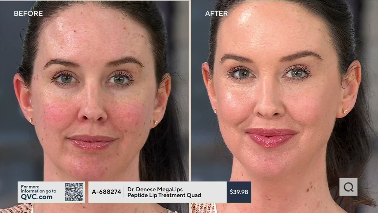 Dr. Denese MegaLips Peptide Lip Treatment Quad on QVC