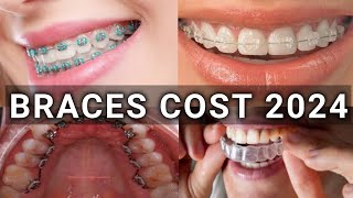 Braces Type & Treatment Cost 2024 Metal Vs Ceramic Vs Lingual Vs Invisalign Braces Latest
