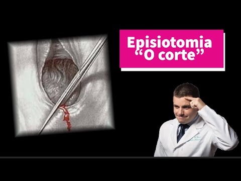 Vídeo: Onde fazer a episiotomia?