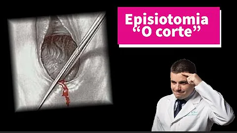 Como é feita a episiotomia?