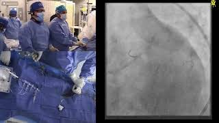 Live Case Presentations #1, #2 and #3