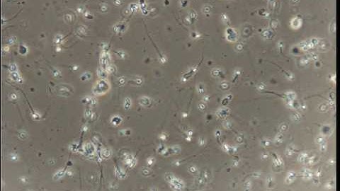 Semen Sample Before PureSperm Gradient