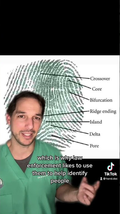 Can you burn off your fingerprints? Hand surgeon explains #Fingerprints #Burn #Medical #Hand