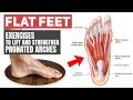 Flat Feet - Rehab Exercises for Pronated Arches