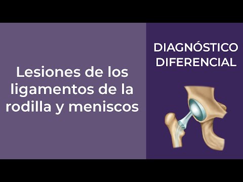 Vídeo: Diferencia Entre Menisco Y Ligamento