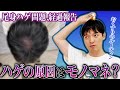 【薄毛】モノマネは頭を蝕む！脂漏性皮膚炎！【AGA】