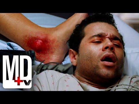 Patient&rsquo;s Girlfriend Carrying a Deadly Infection | Chicago Med | MD TV