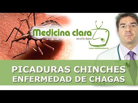 Vídeo: Las Picaduras De Chinches Frente A Las Picaduras De Mosquitos: Distinguiéndolos
