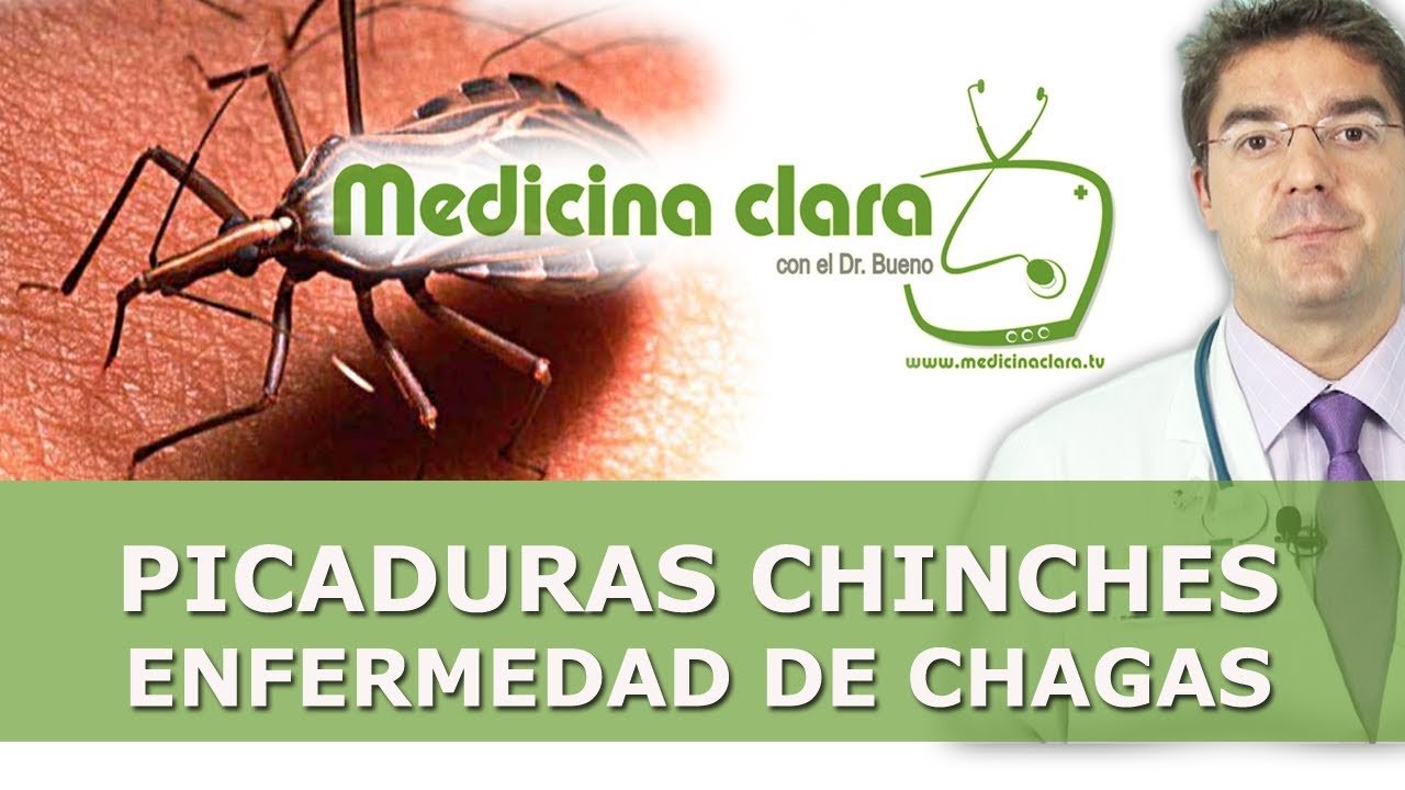 America frío cazar Picadura por chinches y enfermedad de Chagas | Como tratar las picaduras de  chinches - YouTube
