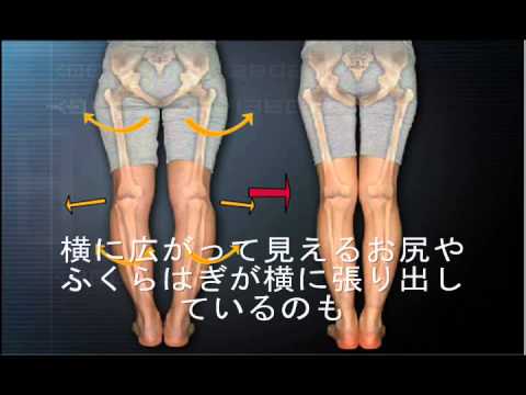 O脚X脚改善 美脚クリエイト スタイレックス 【ひまわり整体院】岩手県花巻市 マッサージ リラクゼー TOP
