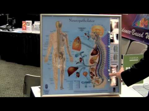 Neuropatholator Wall Chart