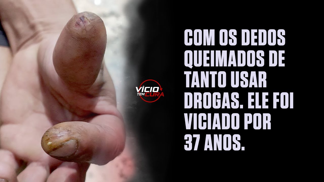 🔴 Alexandre foi escravo dos vícios por mais de 37 anos.