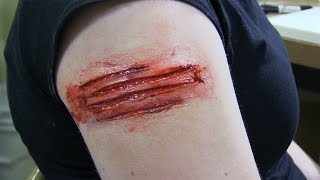 Low Cost Prosthetic Transfers Part 1