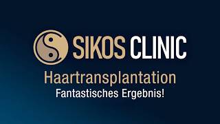 Fantastisches Haartransplantationsergebnis bei der Sikos Clinic!