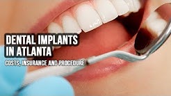 Dental Implants In Atlanta - Costs, Insurance and Procedure [2018] 