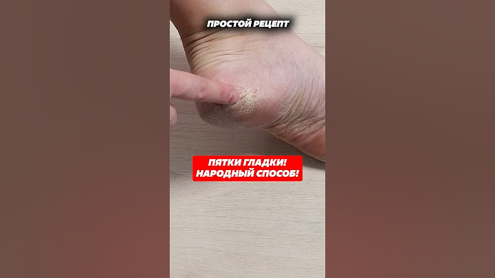 Пятки гладки! Народный способ! #пятки #педикюр #уходзакожей #трещинынапятках #грубаякожа #кожа