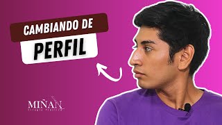 ¡Transformación de impacto! 👃 Cirugía de nariz de Omar | ESPECIALISTA EN RINOPLASTIA