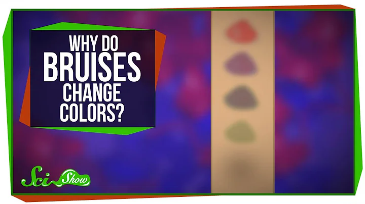 How long does it take for a bruise to form? (2023)