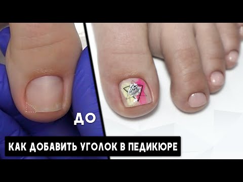 видео: Как доставить уголок в педикюре ✅Ремонт уголка ногтя полигелем ✅ Экспресс дизайн со слайдером