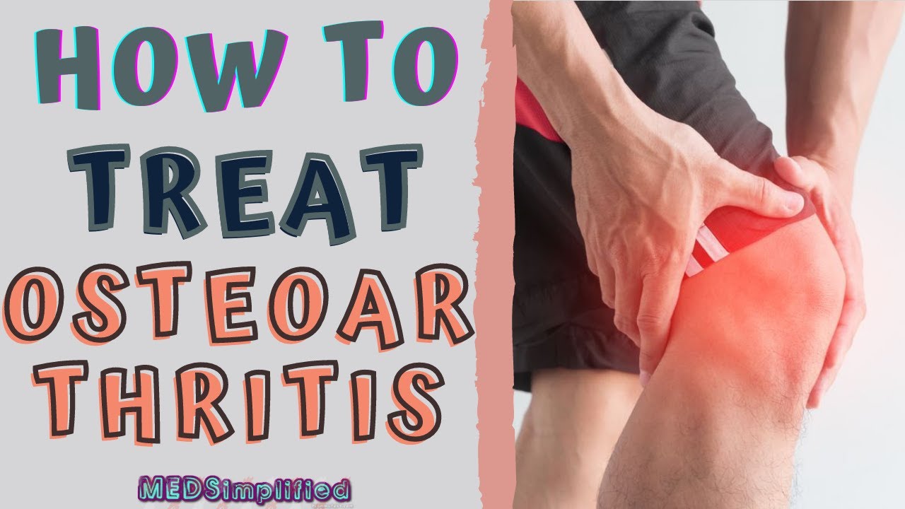 Treating Oa HOW TO TREAT OSTEOARTHRITIS / OA Signs and Symptoms and Management ...