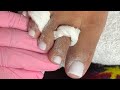 Acrylic toe tutorial | acrylic toes with no forms/ tips