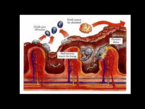 Video: Gaano kaligtas ang food grade diatomaceous earth?