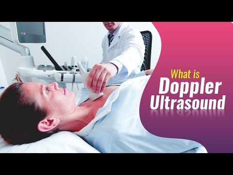 What is Doppler Ultrasound and its Usage?