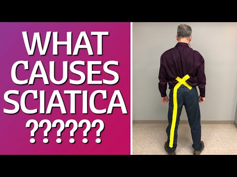 This is Causing Your Sciatica/Back Pain! How to Stop