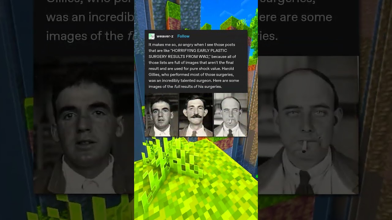 Early Plastic Surgery 🎭