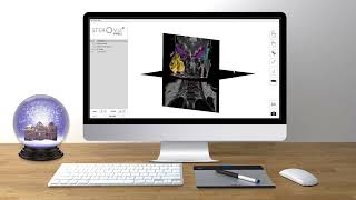 ENHANCE LITE version 1.3- Enhance your surgical planning and visualization screenshot 5