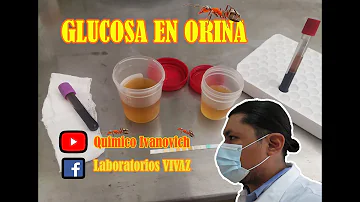 ¿Cómo se sabe si hay azúcar en la orina?