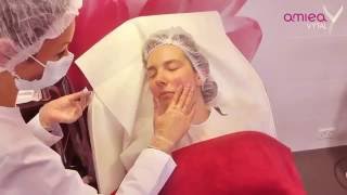 جوانسازی سطحی پوست با دستگاه Amiea Med Revive