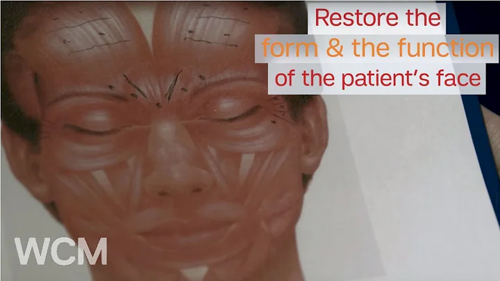 Post-Tumor Facial Reconstruction | Dr. Anthony Scl...