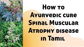 How to Ayurvedic cure Spinal Muscular Atrophy disease.