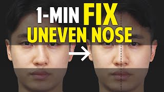 Fix Uneven NoseFacial Asymmetry in 1MinuteBalancing Exercise