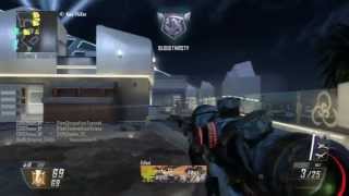 Obey 300k RC (3OB) Response - Focus BF