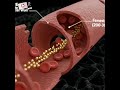 Tumor tissue blood vessels with nano particles #education #quiz #neet #medical #biology #mbbs