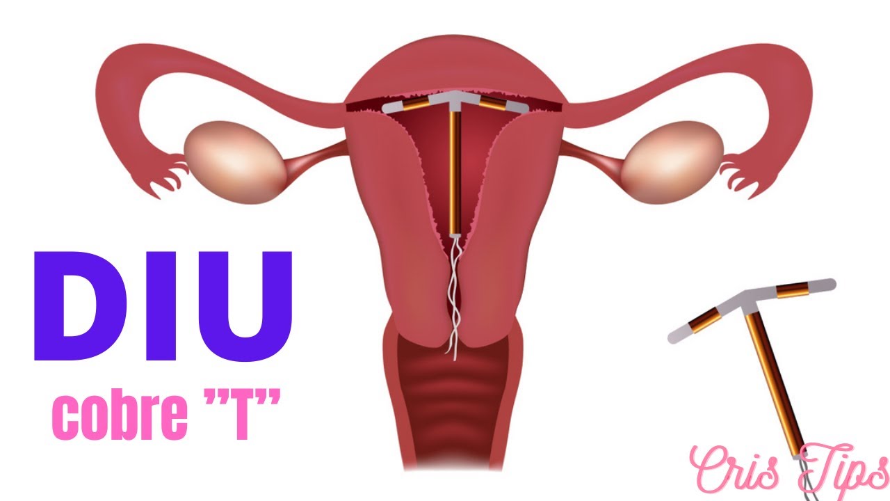 Como funciona una electrovalvula de riego