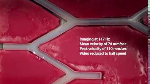 Simultaneous steering and imaging of magnetic particles using MRI