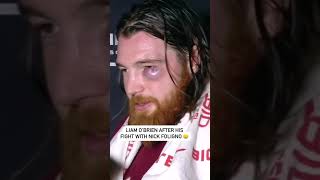 Liam O’Brien has quite the shiner after his fight with Nick Foligno 😳