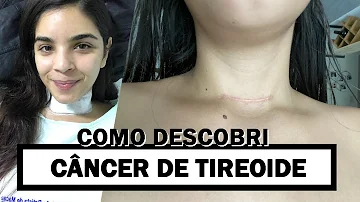 Como descobri câncer de tireoide?