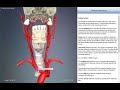 Brachiocephalic trunk | Arteries of head and neck | 3D Human Anatomy | Organs