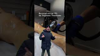 Лазерная эпиляция Soprano Titanium