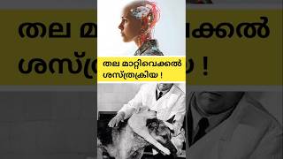Is Human Head Transplation Surgery Possible In Future? | Head Transplantation Interesting Facts